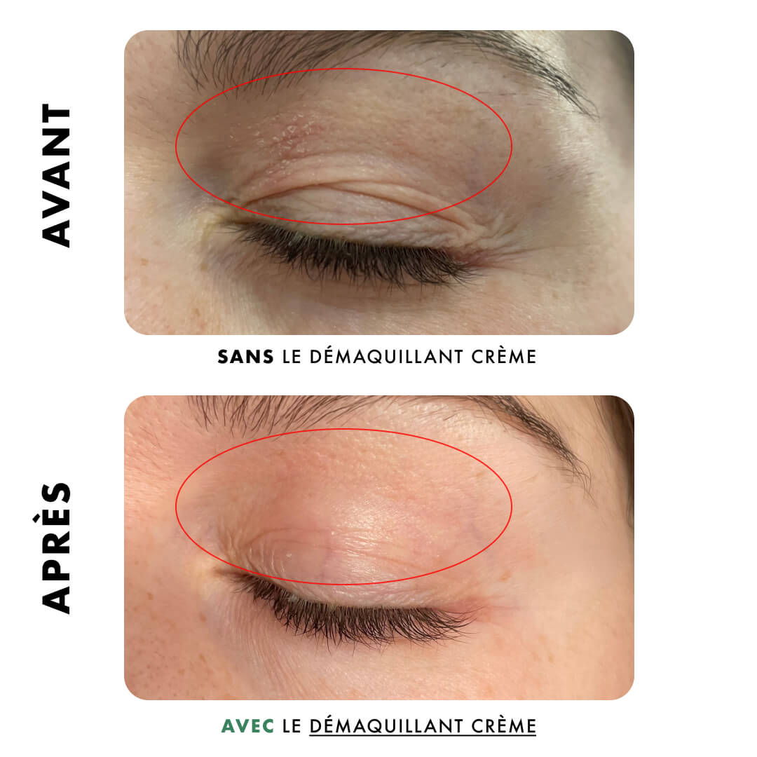 Démaquillant Crème - Apaisant 3en1