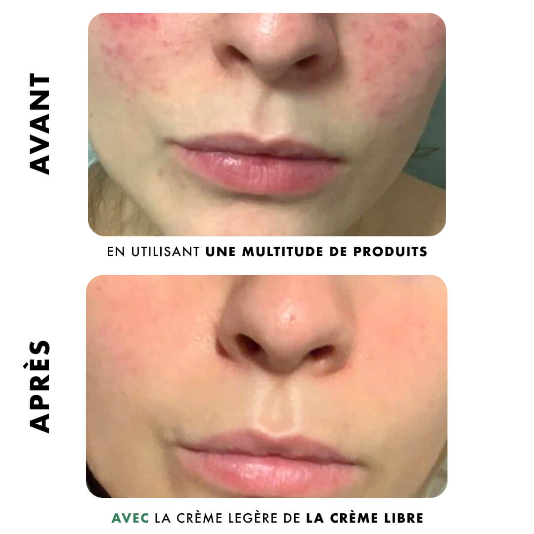 [TEST] Crème Légère - Anti-Imperfections | 30ml